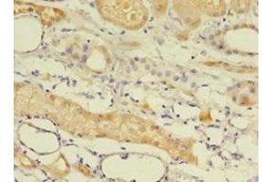 Immunohistochemistry of paraffin-embedded human kidney tissue using ABIN7145562 at dilution of 1:100