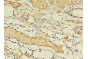 Immunohistochemistry of paraffin-embedded human kidney tissue using ABIN7145562 at dilution of 1:100 (EPHX2 anticorps  (AA 1-555))