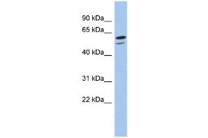 WB Suggested Anti-ZNF248 Antibody Titration:  0. (ZNF248 anticorps  (N-Term))