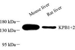 Western blot analysis of KPB1+2 (ABIN7074443) at dilution of 1: 2000,Lane 1: Mouse liver tissue lysate,Lane 2: Rat liver tissue lysate (KPB1/2 anticorps)