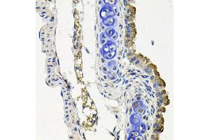 Immunohistochemistry of paraffin-embedded mouse lung using MARK1 antibody (ABIN5974592) at dilution of 1/100 (40x lens). (MARK1 anticorps)