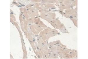 DAB staining on IHC-P Samples:Rat Heart Tissue (Androgen Receptor anticorps  (AA 491-679))