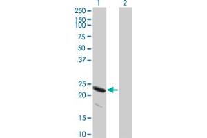 Western Blot analysis of HSPB8 expression in transfected 293T cell line by HSPB8 monoclonal antibody (M04), clone 5B12. (HSPB8 anticorps  (AA 97-196))