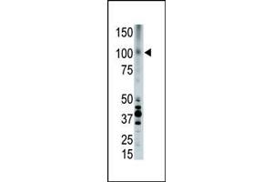 The anti-LRP8 Pab (ABIN390101 and ABIN2840613) is used in Western blot to detect LRP8 in placenta cell lysate.