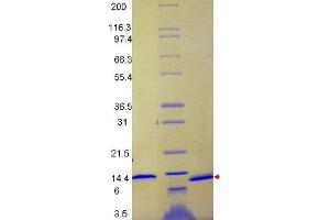 MCP-1 Human Recombinant Cytokine - SDS-PAGE.