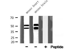 Western blot analysis of GSK3B expression in various lysates