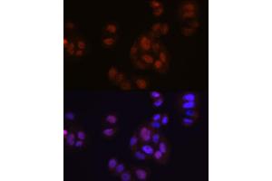 Immunofluorescence analysis of HeLa cells using FGF2 Rabbit mAb (ABIN7267184) at dilution of 1:100 (40x lens). (FGF2 anticorps)