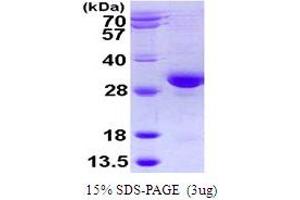 SDS-PAGE (SDS) image for RAB32, Member RAS Oncogene Family (RAB32) (AA 1-225) protein (His tag) (ABIN667585) (RAB32 Protein (AA 1-225) (His tag))