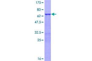 Image no. 1 for Polymerase (DNA Directed), beta (POLB) (AA 1-335) protein (GST tag) (ABIN1315620)