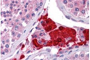 Human Testis: Formalin-Fixed, Paraffin-Embedded (FFPE)