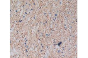 Used in DAB staining on fromalin fixed paraffin- embedded glioma tissue (Plexin A1 anticorps  (AA 43-300))