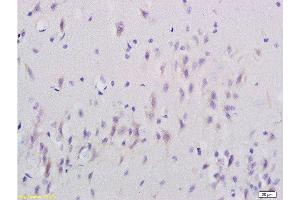 Formalin-fixed and paraffin embedded rat brain labeled with Anti-SNAP25 Polyclonal Antibody, Unconjugated  at 1:200 followed by conjugation to the secondary antibody and DAB staining. (SNAP25 anticorps  (AA 166-206))