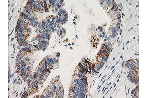 Image no. 5 for anti-Adenylate Kinase 4 (AK4) antibody (ABIN1496526)