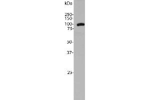 anti-Aldehyde Dehydrogenase H1L1 antibody