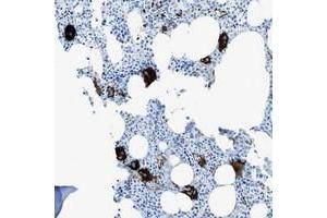 Immunohistochemical staining of human bone marrow with SLC22A15 polyclonal antibody  shows strong cytoplasmic positivity in megakaryocytes. (SLC22A15 anticorps)