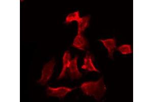ABIN6273837 staining HT29 by IF/ICC. (Serotonin Receptor 3A anticorps  (Internal Region))
