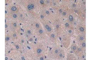 Detection of CTXI in Human Liver Tissue using Monoclonal Antibody to Cross Linked C-Telopeptide Of Type I Collagen (CTXI)