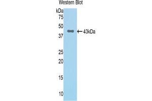 Western blot analysis of the recombinant protein. (Complement Factor B anticorps  (AA 34-159))