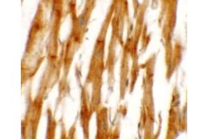 Immunohistochemistry of NCLN in human heart tissue with NCLN antibody at 2.