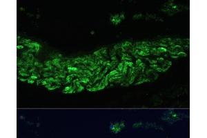Immunofluorescence analysis of Rat lung using ALOX12 Polyclonal Antibody at dilution of 1:100 (40x lens).
