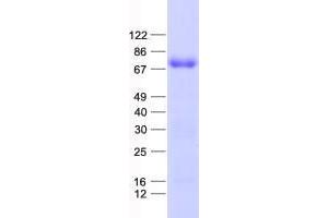 Validation with Western Blot