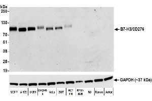 Western Blotting (WB) image for anti-CD276 (CD276) (AA 29-465) antibody (ABIN7455137)