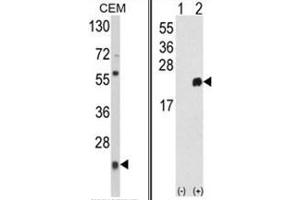 (LEFT) Western blot analysis of PRDX1 Antibody (Center) in CEM cell line lysates (35ug/lane). (Peroxiredoxin 1 anticorps  (Middle Region))