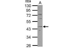 WB Image Sample (30 ug of whole cell lysate) A: K562 10% SDS PAGE antibody diluted at 1:1000 (CCR8 anticorps  (C-Term))
