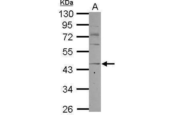 CCR8 anticorps  (C-Term)