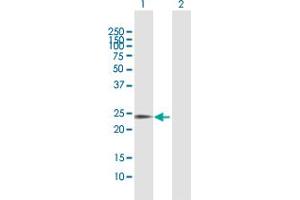 Western Blot analysis of SOHLH2 expression in transfected 293T cell line by SOHLH2 MaxPab polyclonal antibody.