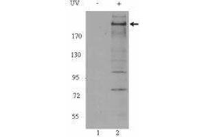 Western Blotting (WB) image for anti-Ataxia Telangiectasia Mutated (ATM) (phosphorylated) antibody (ABIN2666314) (ATM anticorps  (phosphorylated))