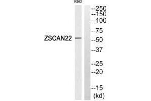 Western blot analysis of extracts from K562 cells, using ZSCAN22 antibody. (ZSCAN22 anticorps)