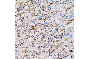 Immunohistochemistry of paraffin-embedded rat brain using MLC3A antibody (ABIN6134219, ABIN6143466, ABIN6143468 and ABIN6215215) at dilution of 1:100 (40x lens).