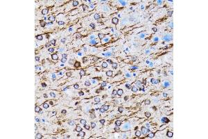 Immunohistochemistry of paraffin-embedded rat brain using MLC3A antibody (ABIN6134219, ABIN6143466, ABIN6143468 and ABIN6215215) at dilution of 1:100 (40x lens). (MAP1LC3A anticorps  (AA 1-100))