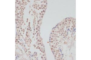 Immunohistochemistry of paraffin-embedded mouse testis using Cyclin G1 antibody (ABIN6127734, ABIN6138095, ABIN6138096 and ABIN6220906) at dilution of 1:100 (40x lens). (Cyclin G1 anticorps  (C-Term))