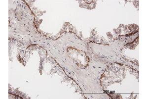 Immunoperoxidase of purified MaxPab antibody to KRT15 on formalin-fixed paraffin-embedded human prostate.