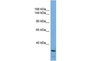 Host: Rabbit Target Name: ARID5B Sample Type: HepG2 Whole Cell lysates Antibody Dilution: 1. (ARID5B anticorps  (N-Term))