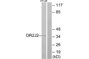 Western blot analysis of extracts from HT-29 cells, using OR2J2 antibody. (OR2J2 anticorps  (C-Term))