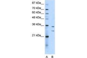 Western Blotting (WB) image for anti-Brix Domain Containing 5 (RPF1) antibody (ABIN2462306) (RPF1 anticorps)