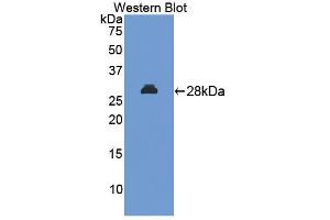 Western blot analysis of the recombinant protein. (MAPKAP Kinase 2 anticorps  (AA 117-337))