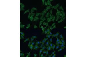 Immunofluorescence analysis of C6 cells using DDX3Y Polyclonal Antibody (ABIN6130260, ABIN6139496, ABIN6139497 and ABIN6215395) at dilution of 1:100 (40x lens).