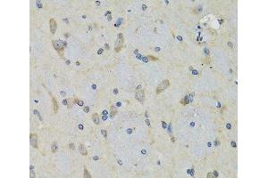 Immunohistochemistry of paraffin-embedded Rat brain using RAE1 Polyclonal Antibody at dilution of 1:100 (40x lens). (RAE1 anticorps)
