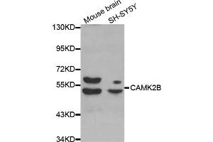 Western Blotting (WB) image for anti-Calcium/calmodulin-Dependent Protein Kinase II beta (CAMK2B) antibody (ABIN1871413) (CAMK2B anticorps)