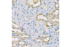 Immunohistochemistry of paraffin-embedded rat kidney using HS1BP3 antibody.