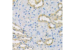 Immunohistochemistry of paraffin-embedded rat kidney using HS1BP3 antibody. (HS1BP3 anticorps  (AA 1-200))