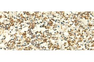 Immunohistochemistry of paraffin-embedded Human tonsil tissue using IFT27 Polyclonal Antibody at dilution of 1:50(x200)