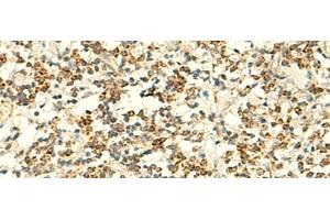 Immunohistochemistry of paraffin-embedded Human tonsil tissue using IFT27 Polyclonal Antibody at dilution of 1:50(x200) (RABL4 anticorps)