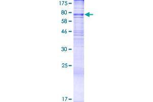 Image no. 1 for Asparagine-Linked Glycosylation 9, alpha-1,2-Mannosyltransferase (ALG9) (AA 1-618) protein (GST tag) (ABIN1344886)