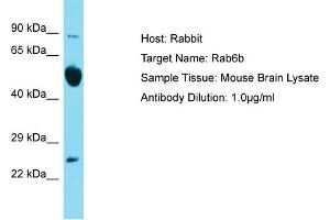 Host: Rabbit Target Name: Rab6b Sample Type: Mouse Brain lysates Antibody Dilution: 1.