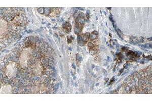 ABIN6278988 at 1/100 staining Human prostate tissue by IHC-P.